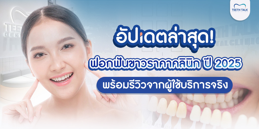 อัปเดตล่าสุด! ฟอกฟันขาวราคาคลินิก ปี 2025 พร้อมรีวิวจากผู้ใช้บริการจริง
