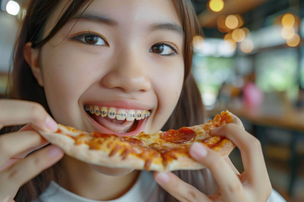 จัดฟันควรกินอาหารแแบบไหนดี?