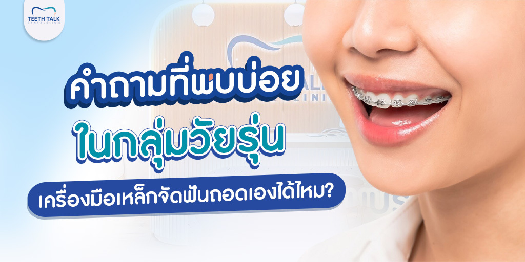คำถามที่พบบ่อยในกลุ่มวัยรุ่น เครื่องมือเหล็กจัดฟัน ถอดเองได้ไหม?