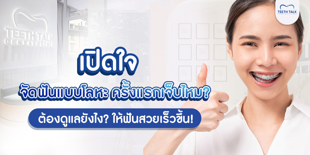 เปิดใจ จัดฟันแบบโลหะ ครั้งแรกเจ็บไหม? ต้องดูแลยังไง? ให้ฟันสวยเร็วขึ้น!