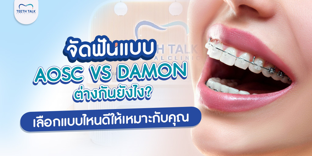 จัดฟันแบบ aosc vs Damon ต่างกันยังไง? เลือกแบบไหนดีให้เหมาะกับคุณ