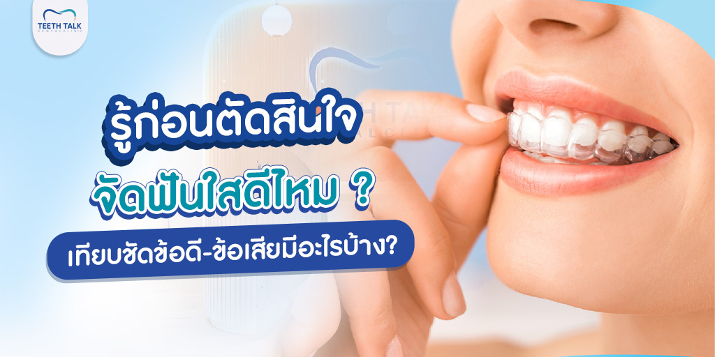 รู้ก่อนตัดสินใจ จัดฟันใสดีไหม ? เทียบชัดข้อดี-ข้อเสียมีอะไรบ้าง?
