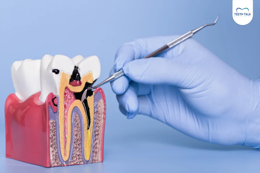 วิธีรักษารากฟัน