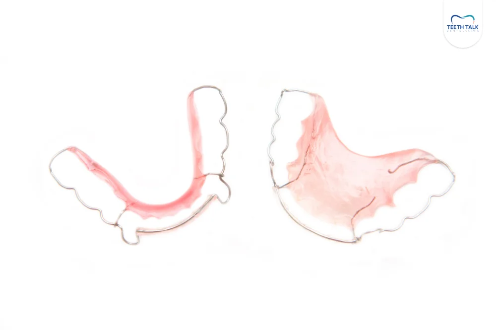 ทำไมต้องใส่รีเทนเนอร์ลวดหลังจัดฟัน
