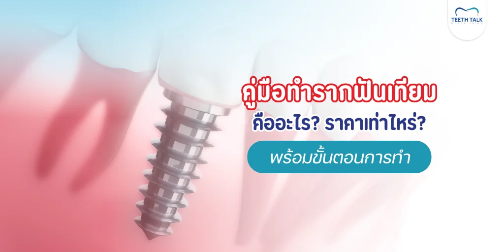 คู่มือทำรากฟันเทียม