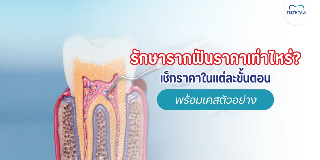 รักษารากฟันราคาเท่าไหร่