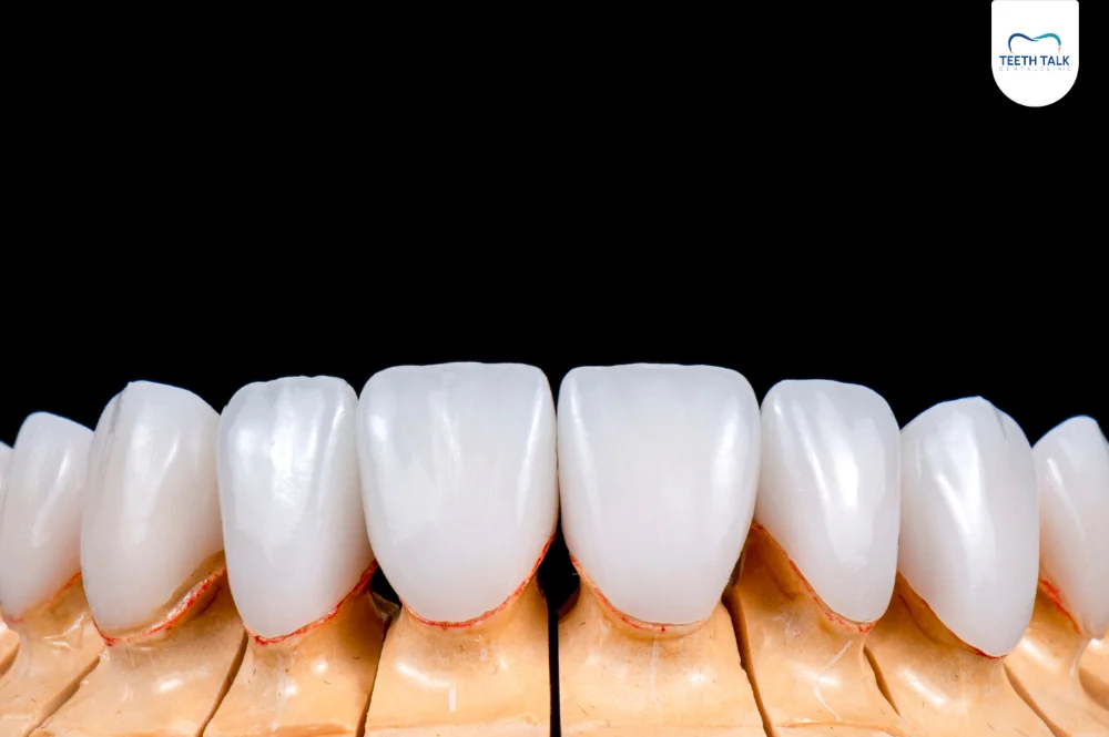 คำถามที่พบบ่อยเกี่ยวกับราคาวีเนียร์