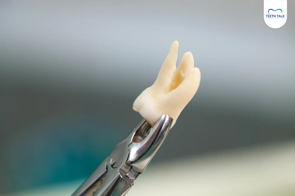 ฟันคุดแบบไหนต้องผ่า