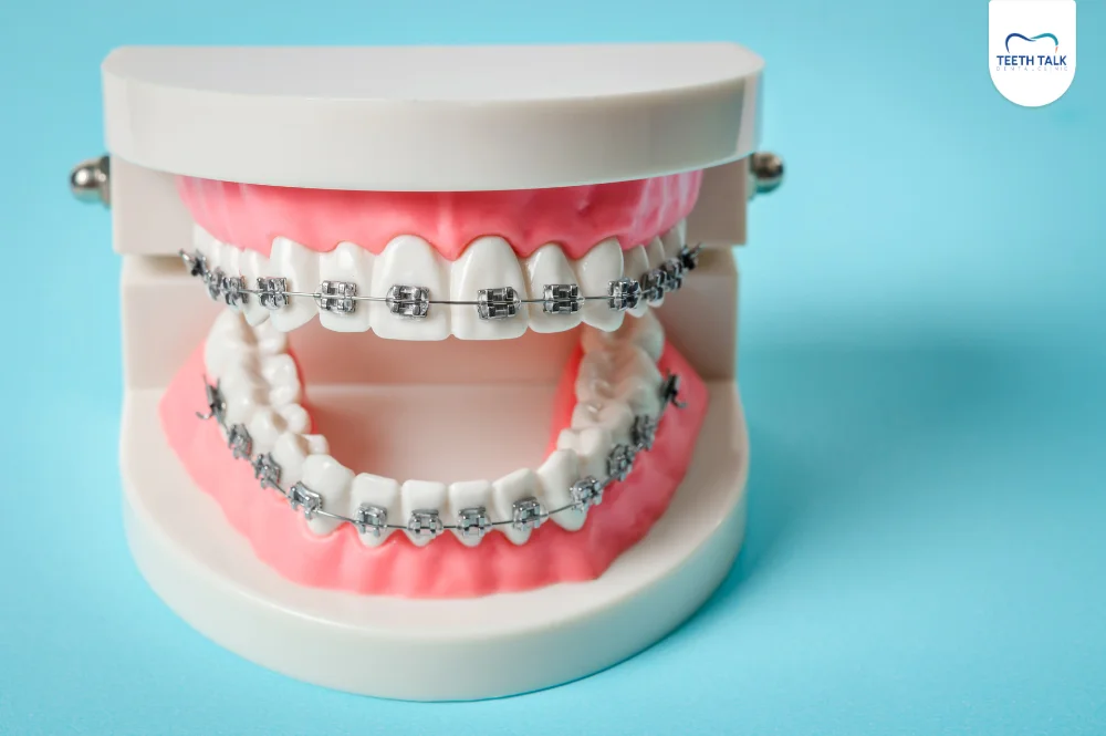 ฟันยื่นแก้ยังไง