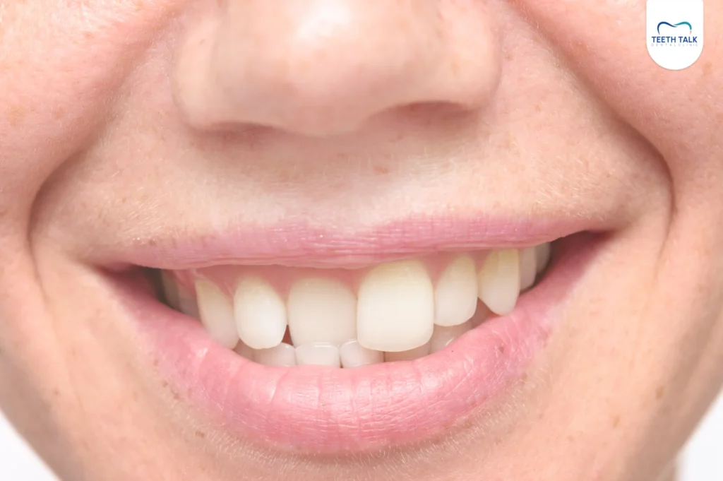 ฟันงุ้มส่งผลเสีย