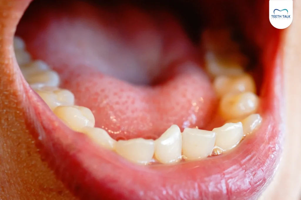 แนวทางการรักษา