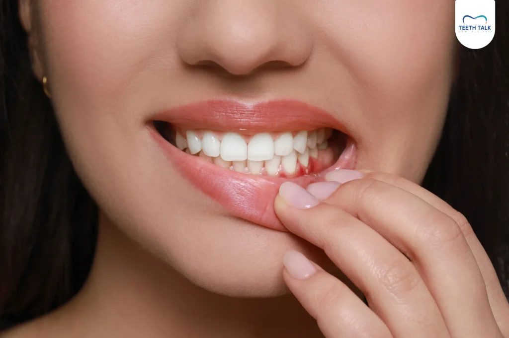 ลือดออกตามไรฟัน