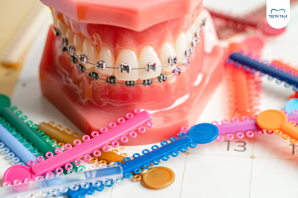 เลือกสียางจัดฟันเสริมดวง