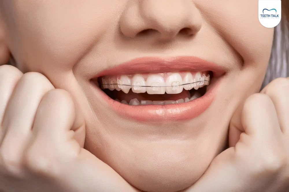 ปัจจัยที่ส่งผลต่อราคาจัดฟันแบบดามอน