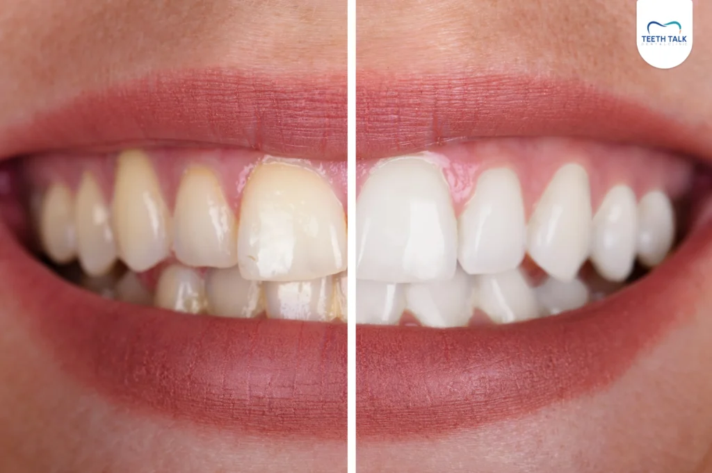 ฟันเหลืองปัญหา