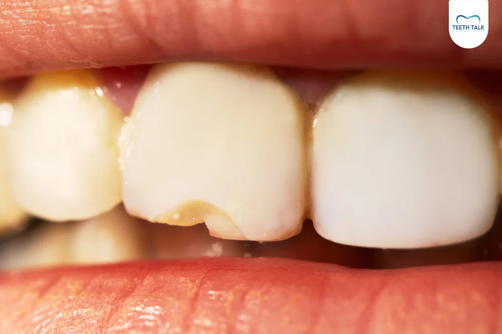 จะรู้ได้อย่างไรว่ามีอาการฟันแตก