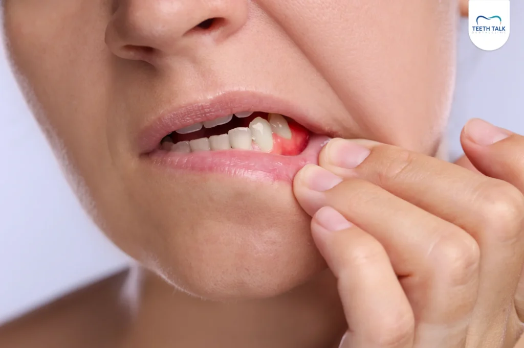 สาเหตุเหงือกร่น