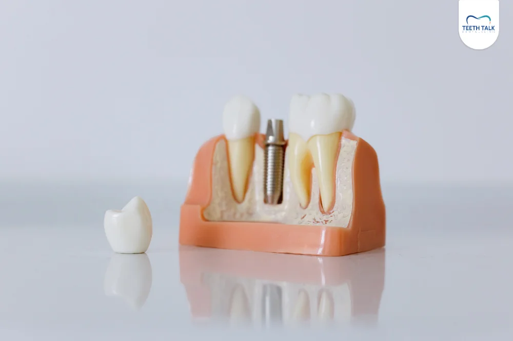 ทำครอบฟันที่ Teeth Talk Dental Clinic