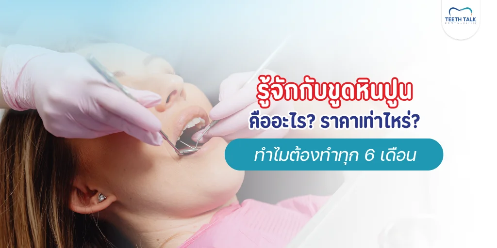 ขูดหินปูน