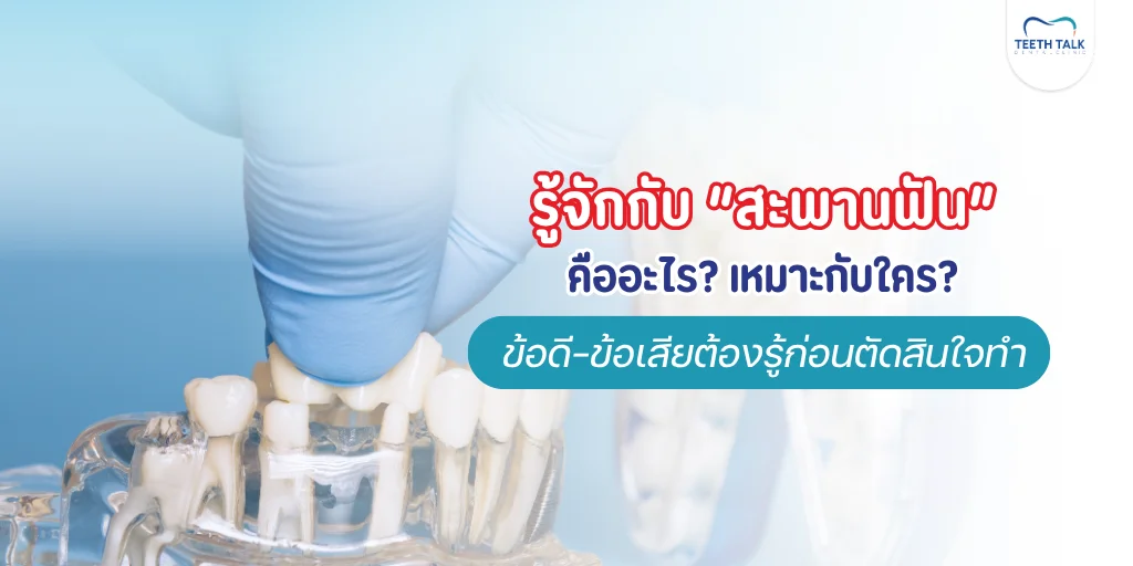 สะพานฟัน