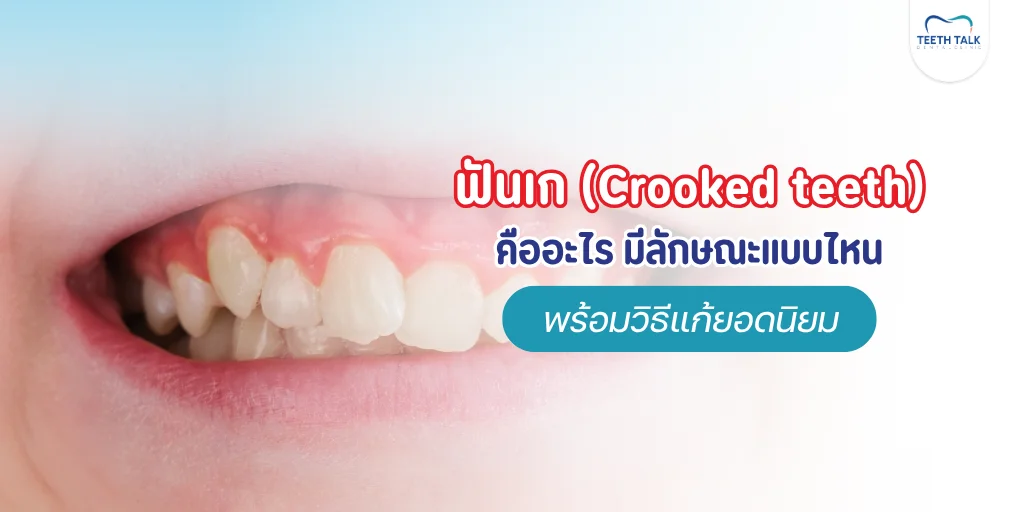 ฟันเก Crooked teeth