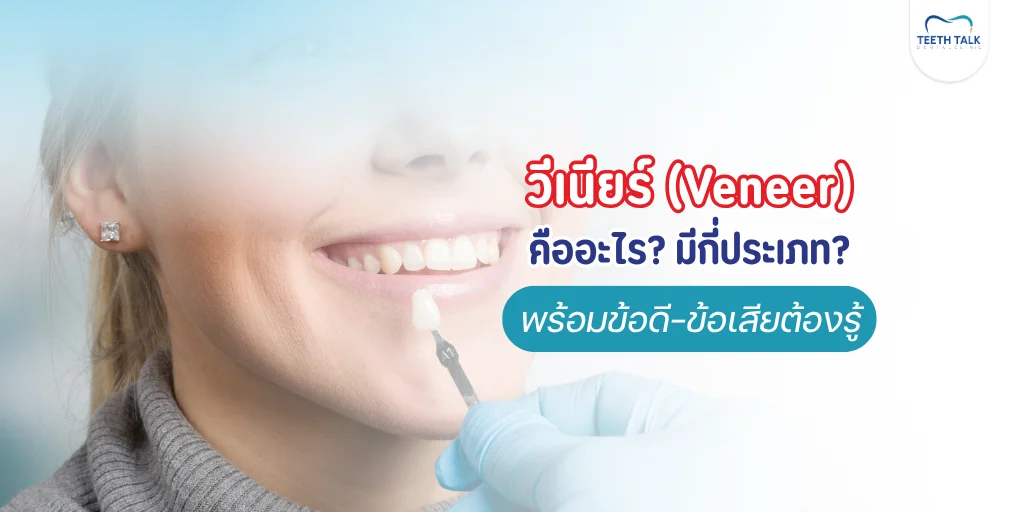 วีเนียร์ คืออะไร