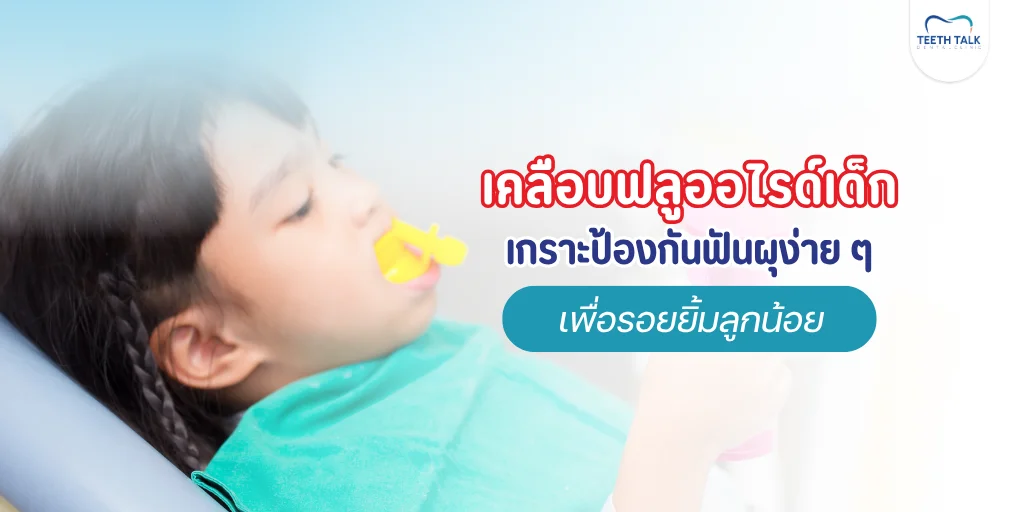 เคลือบฟลูออไรด์เด็ก คืออะไร