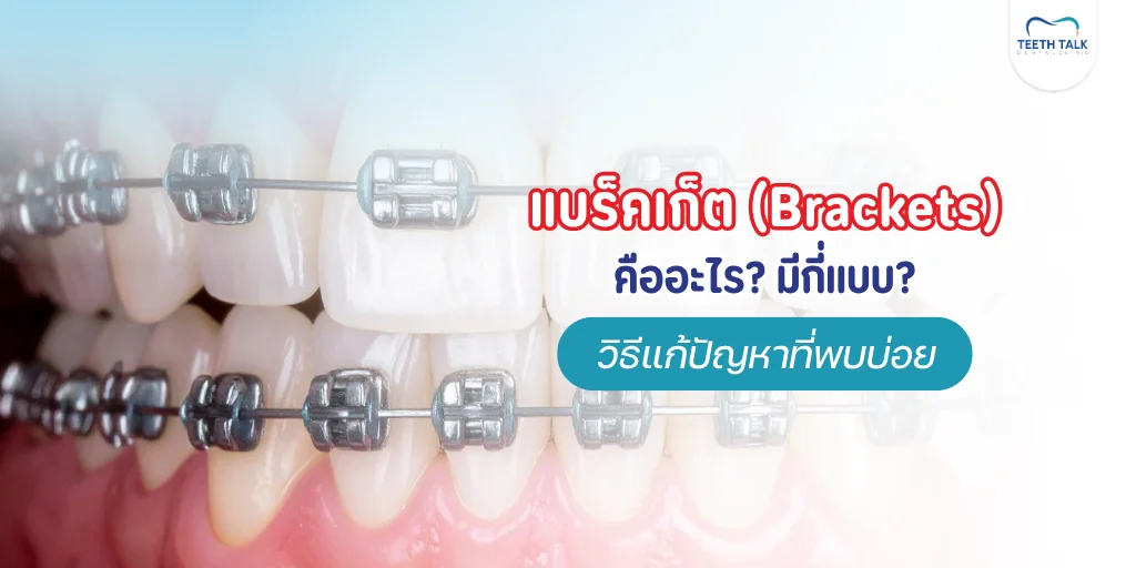 แบร็คเก็ตจัดฟันคืออะไร