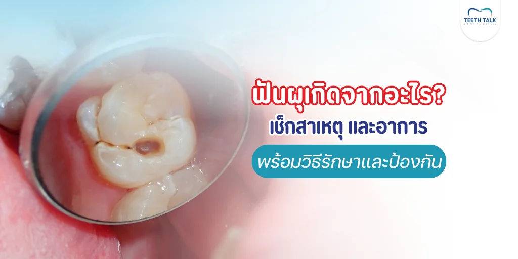 ฟันผุเกิดจากอะไร