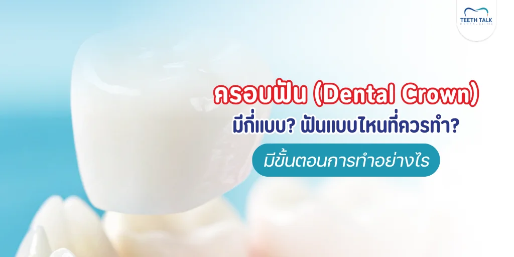 ครอบฟัน Dental Crown