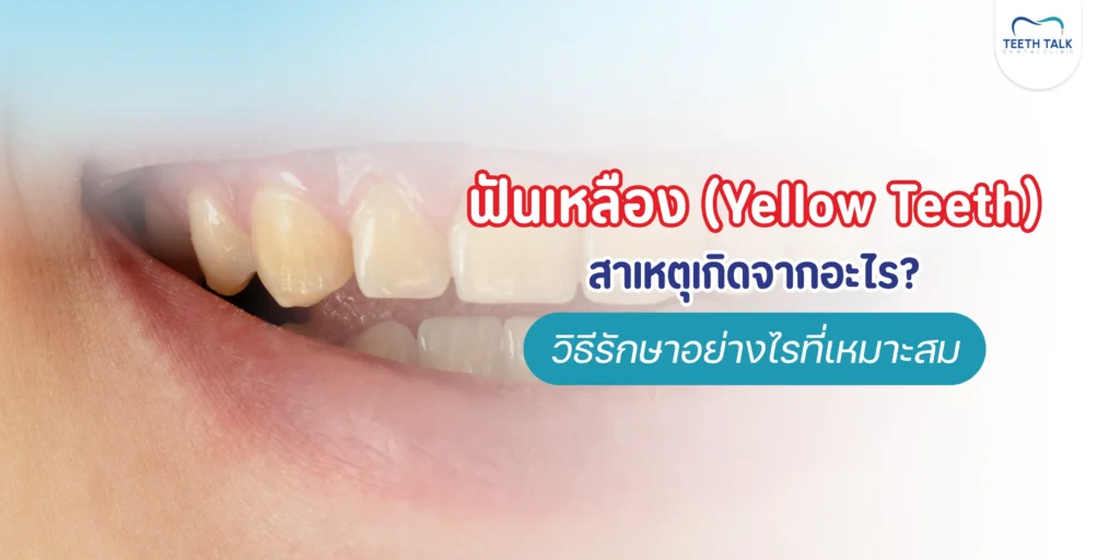 ฟันเหลืองเกิดจากอะไร