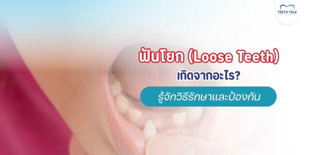 อาการฟันโยก