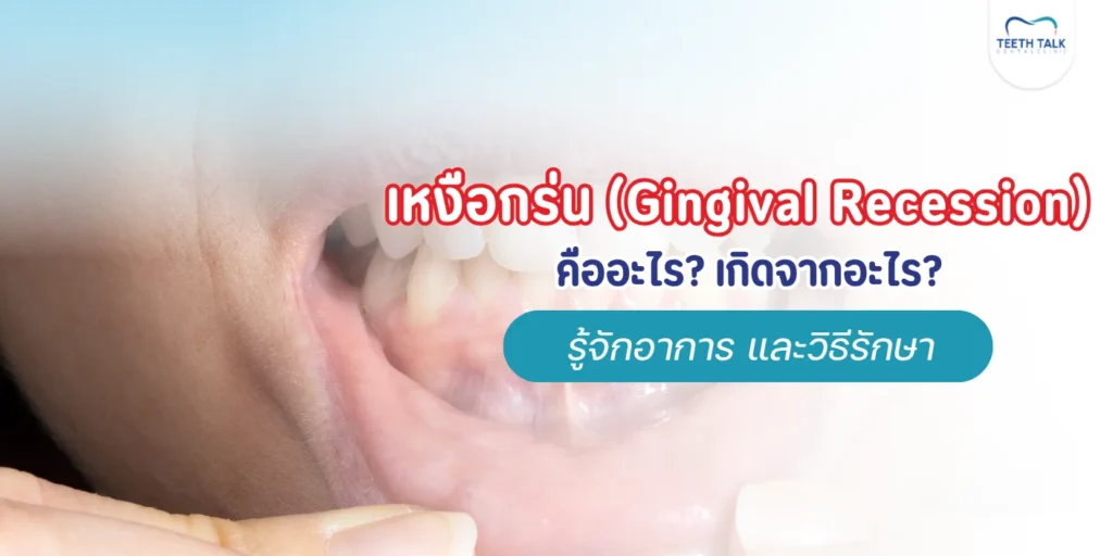 เหงือกร่นรักษาได้