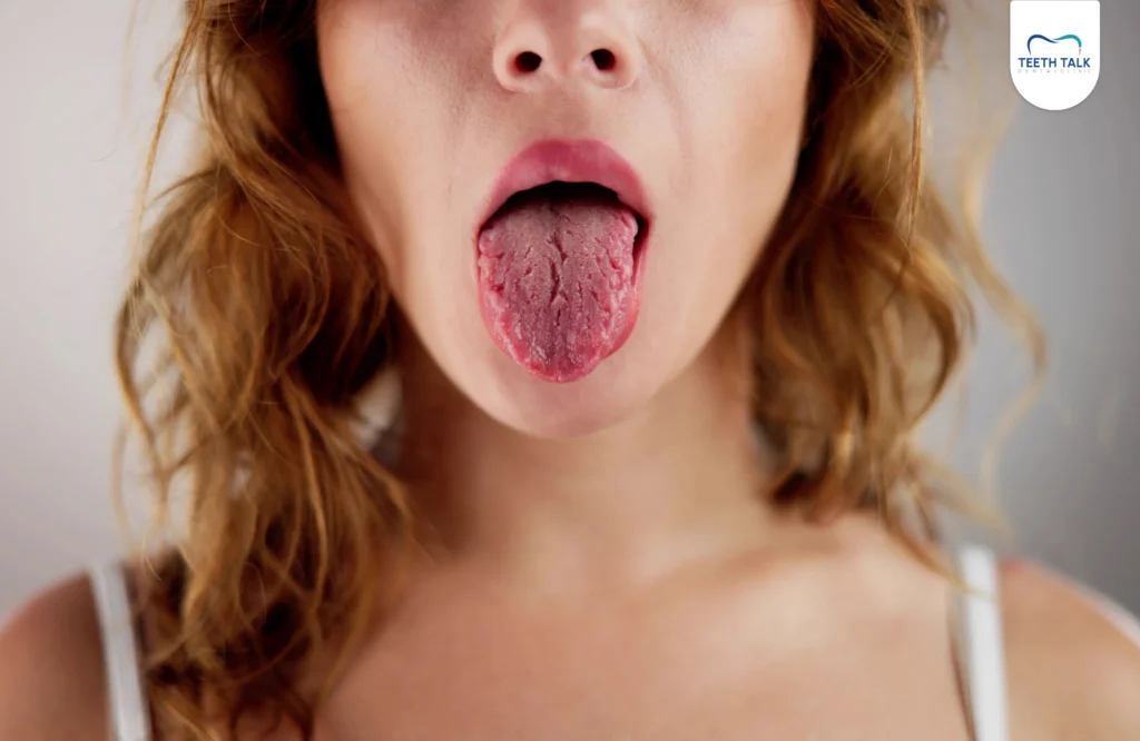 ลิ้นเป็นแผลเกิดจากอะไร