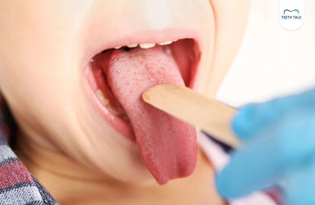 วิธีดูแลเมื่อลิ้นเป็นแผล