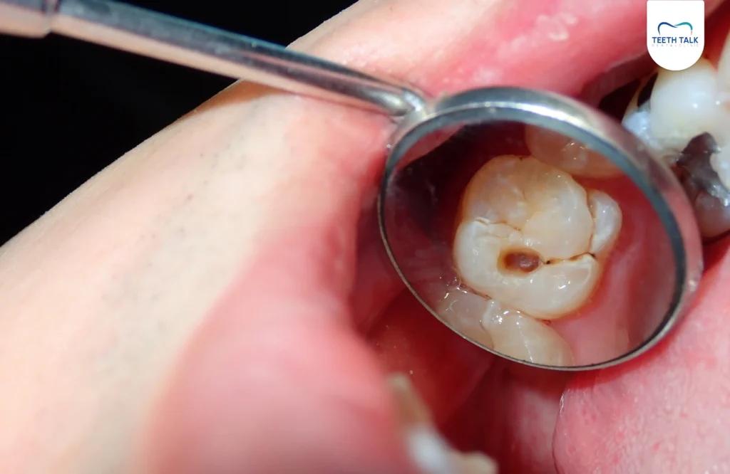 ผลกระทบจากคราบพลัค