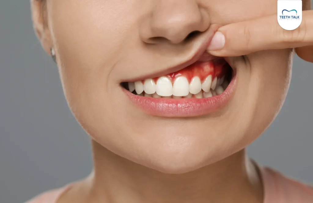 เหงือกเป็นหนองเกิดจากอะไร