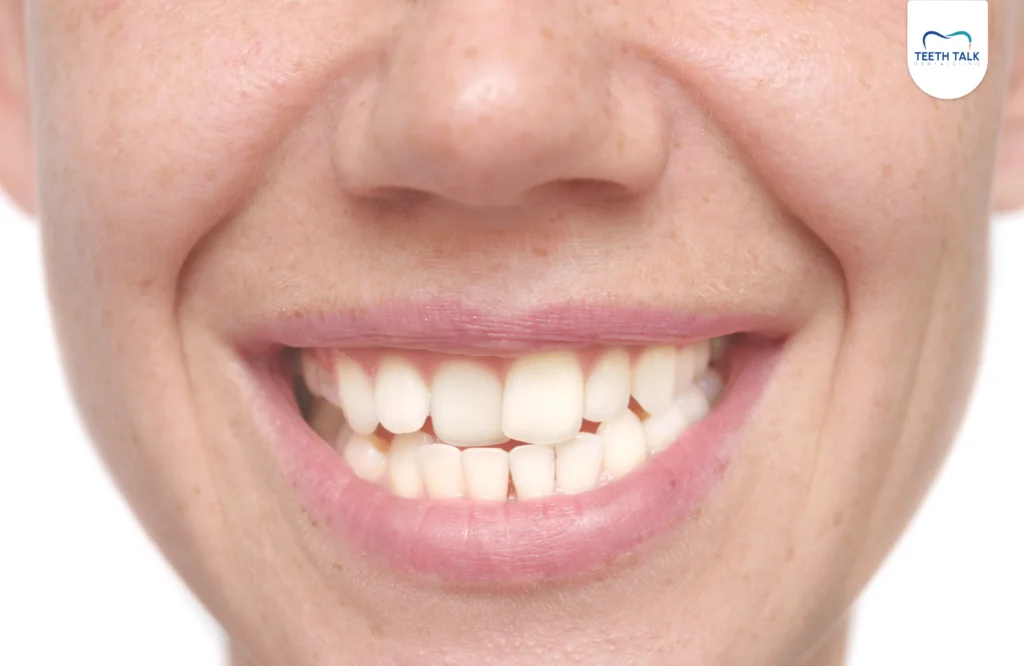 เคี้ยวข้าวข้างเดียว ทำให้หน้าเบี้ยวจริงไหม? รู้ทันสาเหตุ ผลเสีย และวิธีแก้ไข