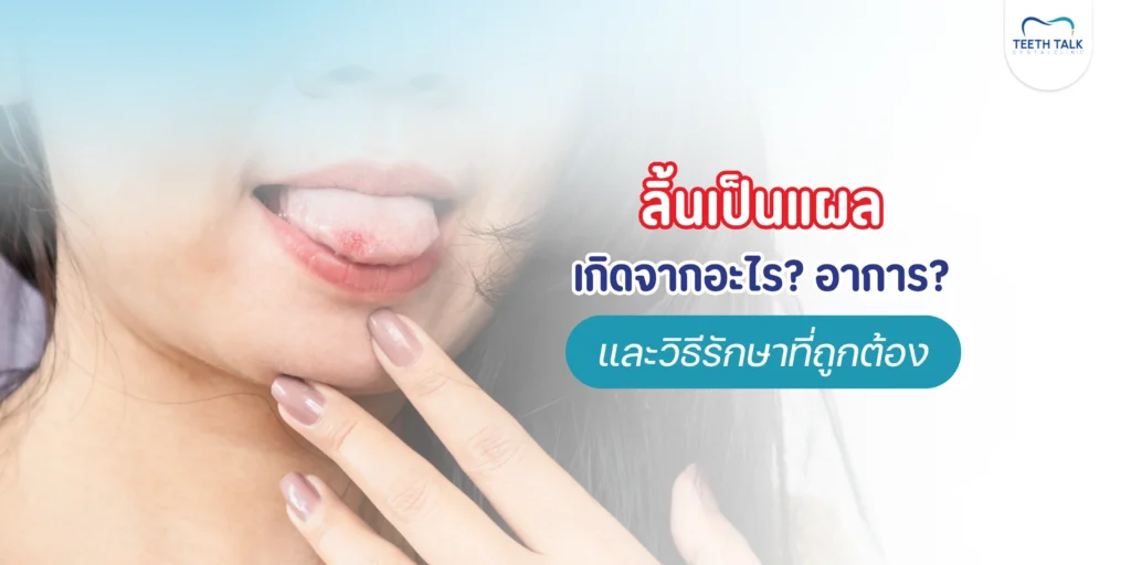 ลิ้นเป็นแผลอันตรายไหม