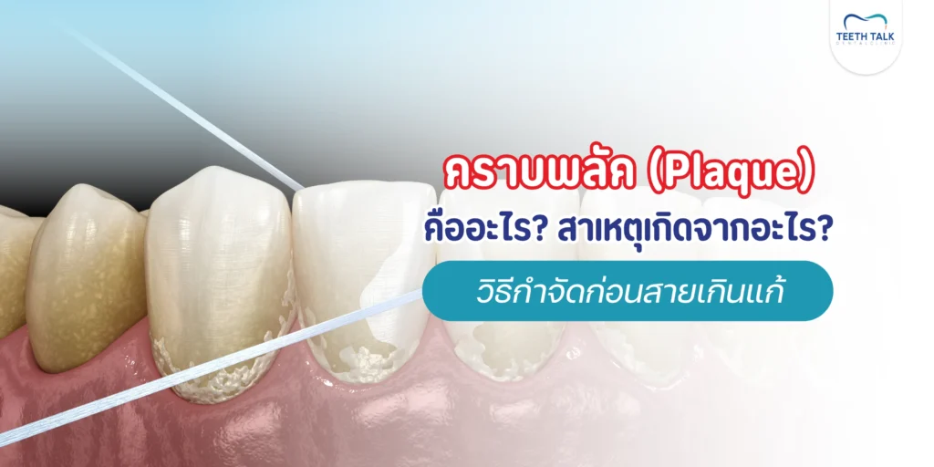 คราบพลัคตัวร้ายเกาะฟัน