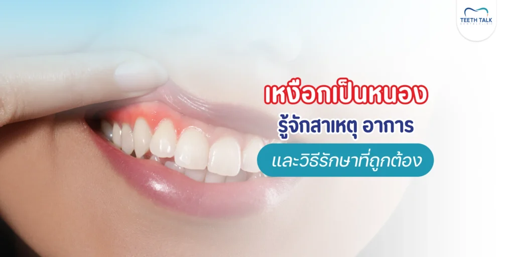 เหงือกเป็นหนอง