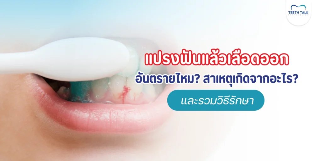 แปรงฟันแล้วเลือดออก