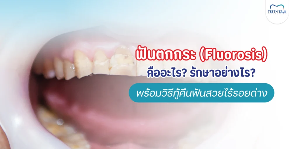ฟันตกกระคืออะไร