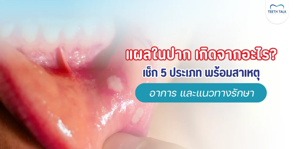 แผลในปากเกิดจากอะไร