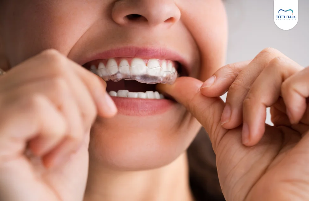 ทำไมต้องจัดฟันใส Invisalign Express ที่ TEETH TALK DENTAL CLINIC