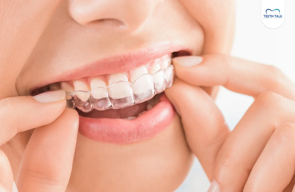 ทำไมต้องจัดฟันใส Invisalign Essential ที่ TEETH TALK DENTAL CLINIC