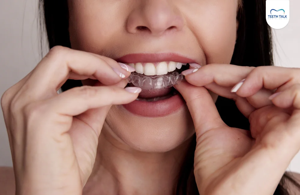 ทำไมต้องจัดฟันใส Invisalign Moderate ที่ TEETH TALK DENTAL CLINIC