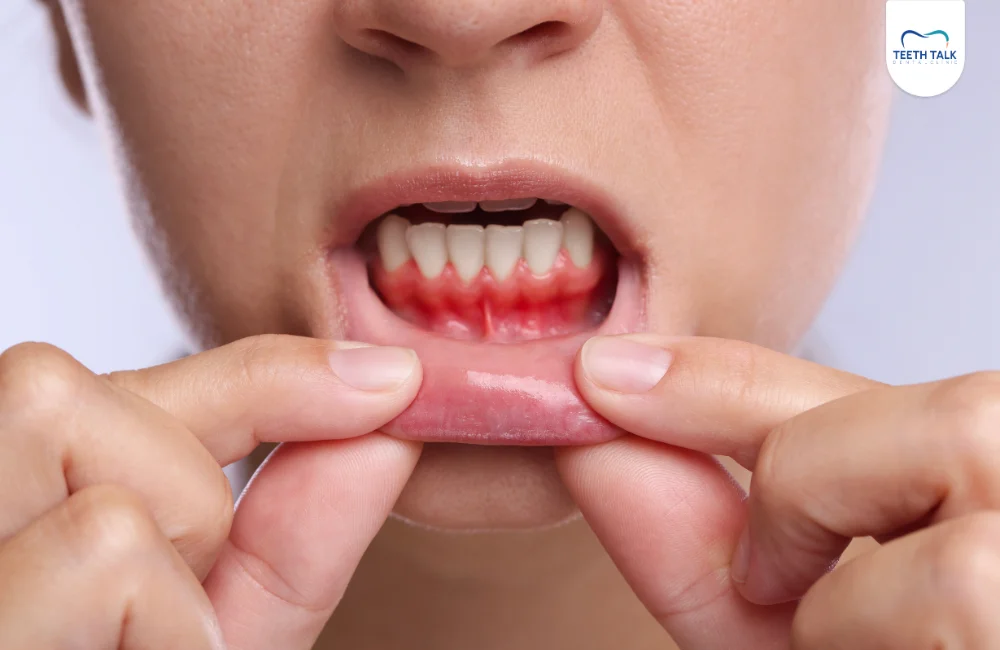 วิธีการปลูกเหงือกมีกี่แบบ