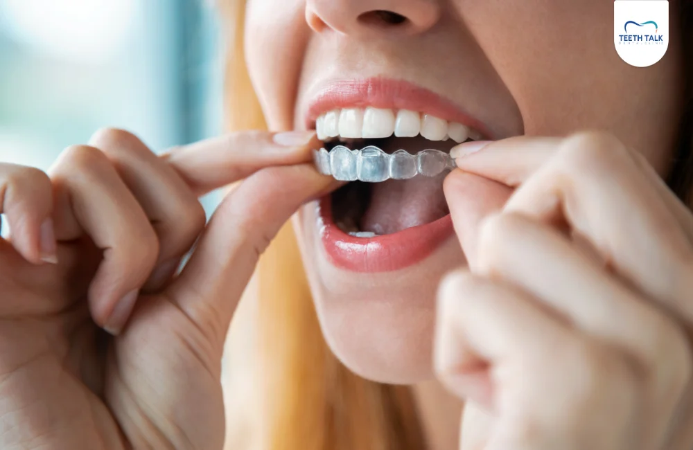ทำไมต้องจัดฟันใส Invisalign (Clear Aligner) ที่ TEETH TALK DENTAL CLINIC