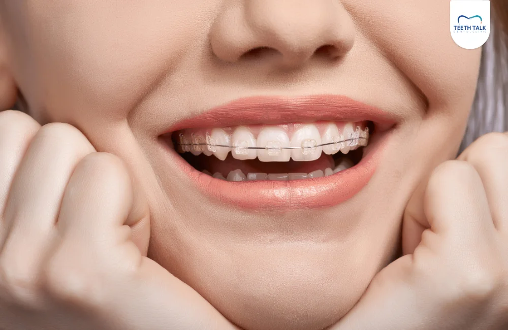 ทำไมต้องเลือกจัดฟันแบบเหล็กเส้นเดียวที่ TEETH TALK DENTAL CLINIC